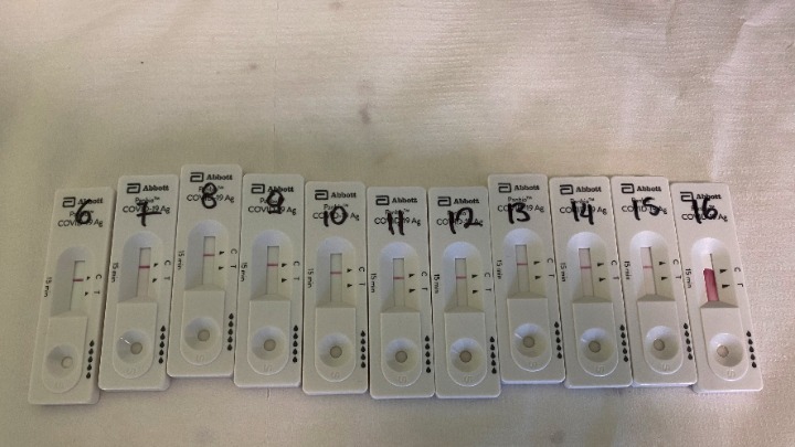 Κορωνοϊός: 591 νέα κρούσματα, 360 διασωληνωμένοι, 21 θάνατοι