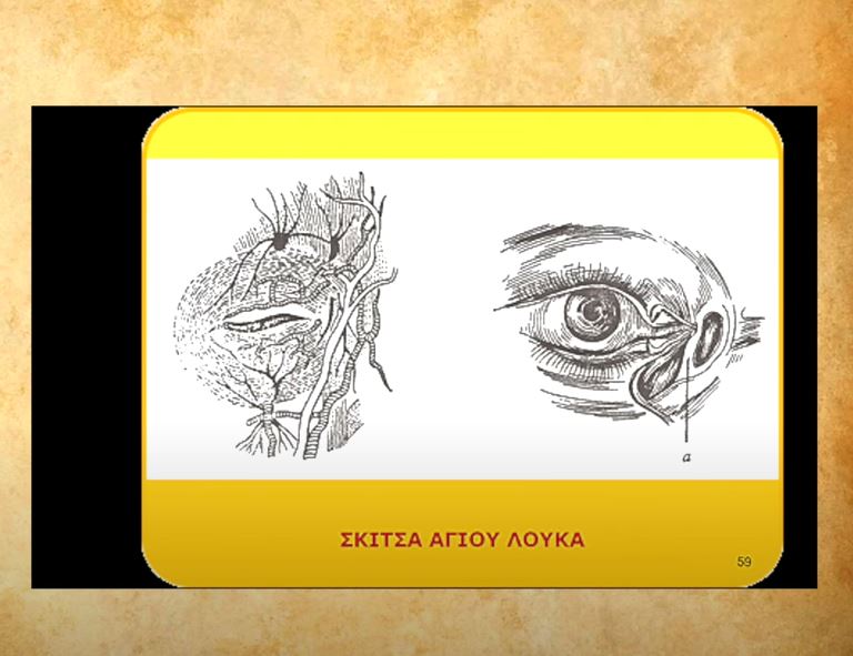 ΣΤΙΓΜΙΟΤΥΠΟ “ΟΡΘΟΔΟΞΙΑ”: Σκίτσα του Αγίου Λουκά του Ιατρού